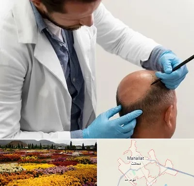 کاشت مو به روش تکثیری در محلات