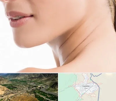 جراحی فک با لیزر در اسدآباد