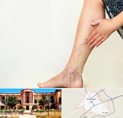دکتر واریس در خمین