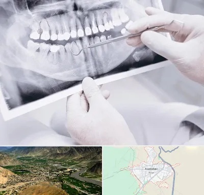 رادیولوژی دهان و دندان در اسدآباد
