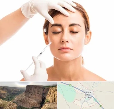 تزریق ژل گونه در سرپل ذهاب