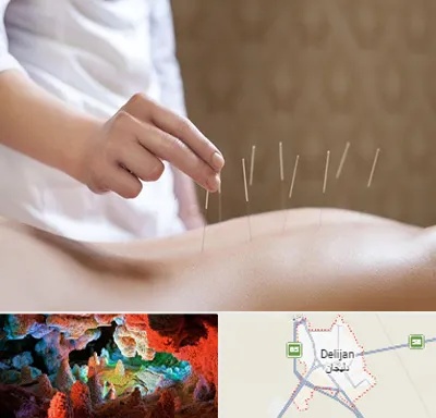 درای نیدلینگ در دلیجان