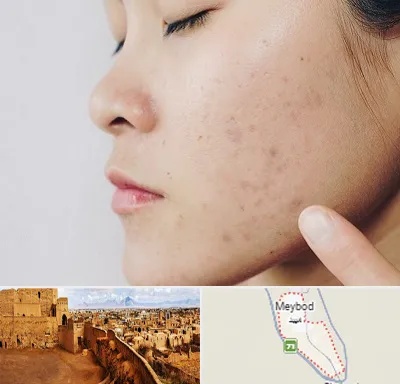 دکتر جوش صورت در میبد