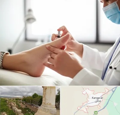 متخصص زخم دیابت در کنگاور