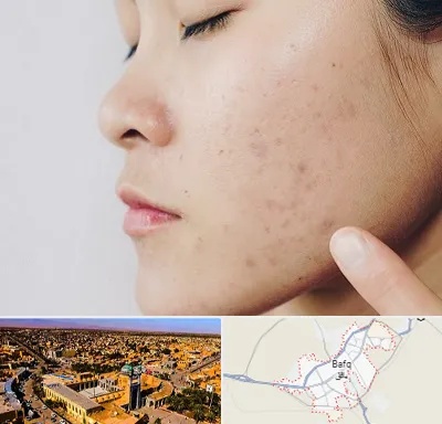 دکتر جوش صورت در بافق