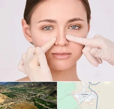 جراح راینوپلاستی در اسدآباد