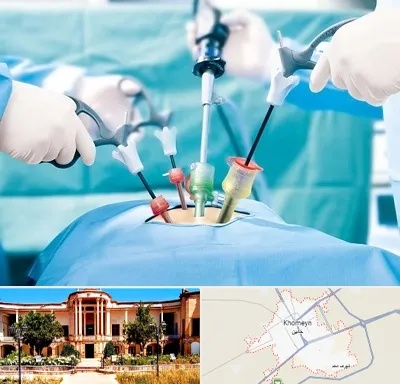 دکتر لاپاراسکوپی در خمین