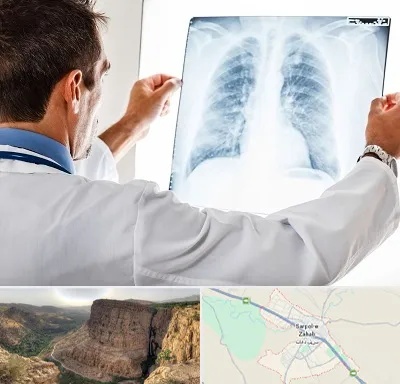 دکتر متخصص ریه در سرپل ذهاب
