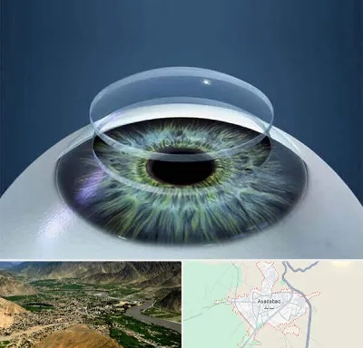 پیوند قرنیه در اسدآباد