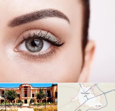 فوق تخصص عنبیه در خمین