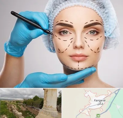 جراح فک و صورت در کنگاور