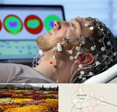 مرکز نوار مغز در محلات