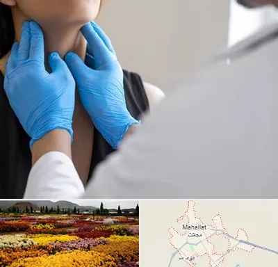 دکتر سرطان گلو در محلات