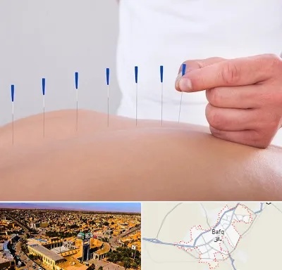 دکتر طب سوزنی در بافق