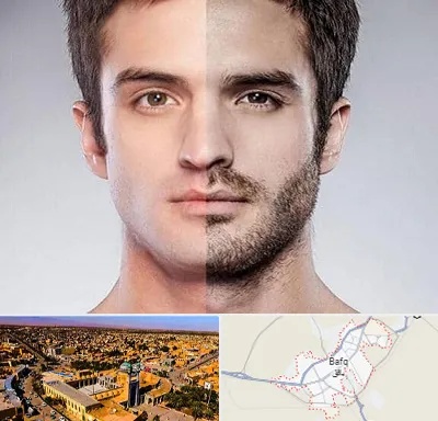 کاشت ریش و سبیل در بافق