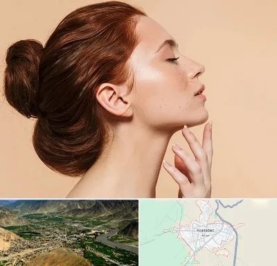 جراحی غبغب در اسدآباد