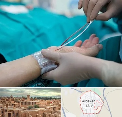 آنژیوگرافی در اردکان