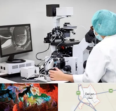 آزمایشگاه اسپرموگرام در دلیجان