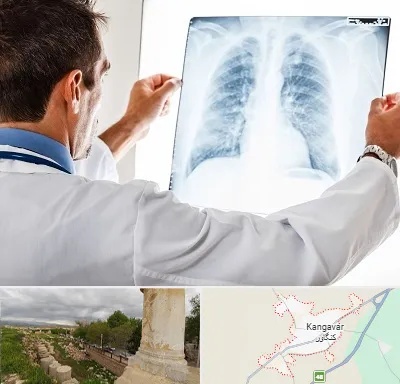 دکتر متخصص ریه در کنگاور