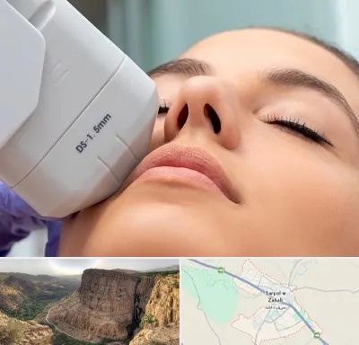 هایفوتراپی در سرپل ذهاب