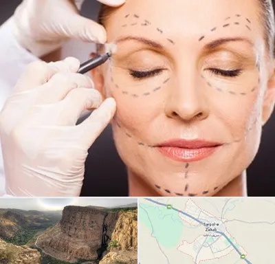 دکتر زیبایی صورت در سرپل ذهاب