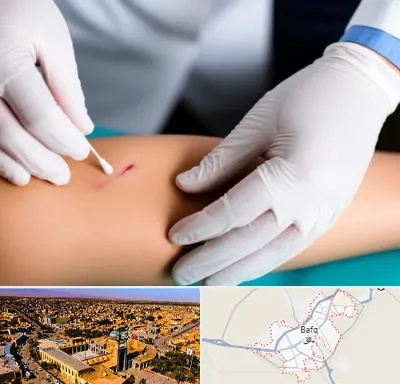 متخصص زخم عفونی در بافق