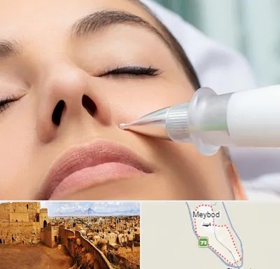 پلاسما جت بینی در میبد