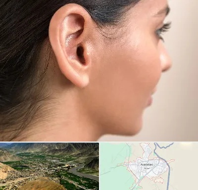 عمل گوش بل در اسدآباد
