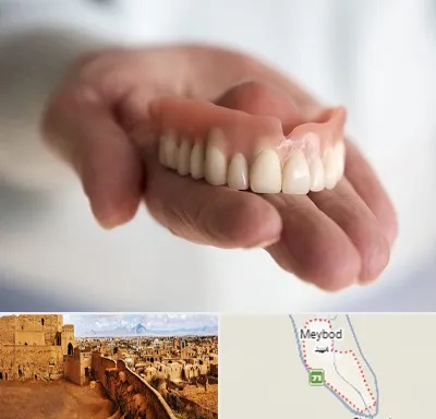 لیفت لثه با لیزر در میبد