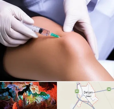 پلاسما درمانی PRP در دلیجان