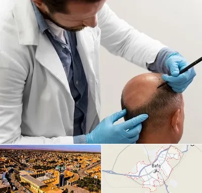 کاشت مو به روش تکثیری در بافق
