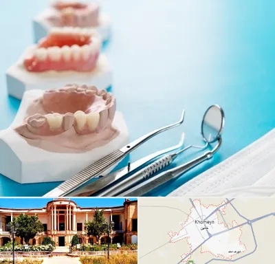 متخصص روکش دندان در خمین