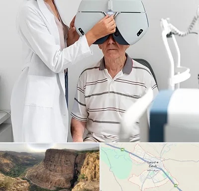 دکتر سرطان چشم در سرپل ذهاب