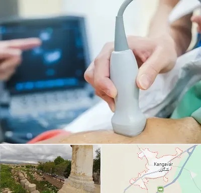 اکو قلب شبانه روزی در کنگاور