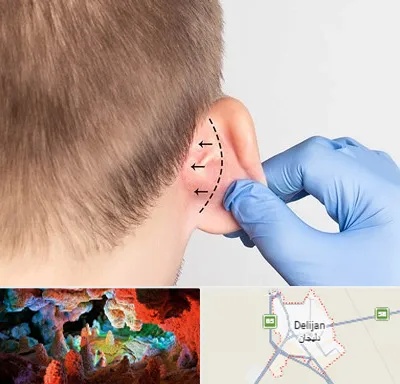 عمل زیبایی گوش در دلیجان