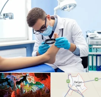 درمان زخم پای دیابتی در دلیجان