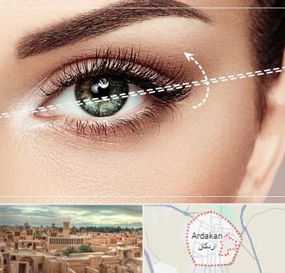 جراحی چشم گربه ای در اردکان