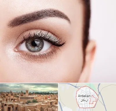 فوق تخصص عنبیه در اردکان
