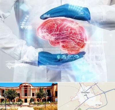 دکتر مغز و اعصاب در خمین