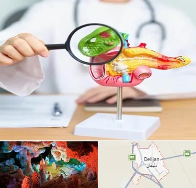 جراح سرطان پانکراس در دلیجان