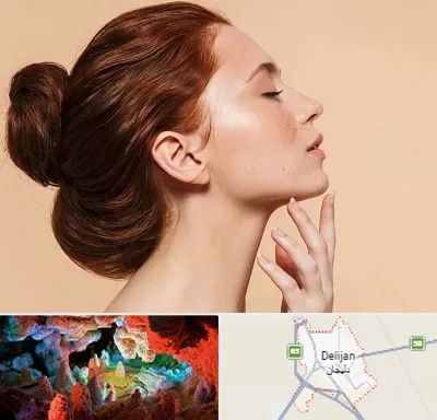 جراحی غبغب در دلیجان