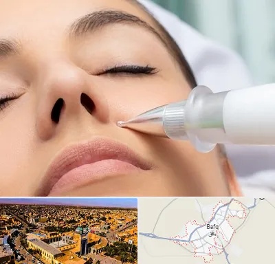 پلاسما جت بینی در بافق