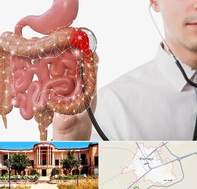 دکتر سرطان روده بزرگ در خمین