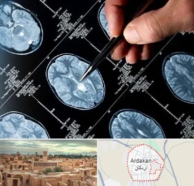 دکتر تشنج در اردکان