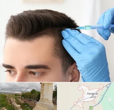 مزوتراپی مو در کنگاور