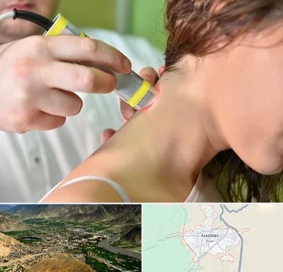 لیزر درمانی در اسدآباد