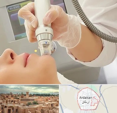آر اف فرکشنال در اردکان