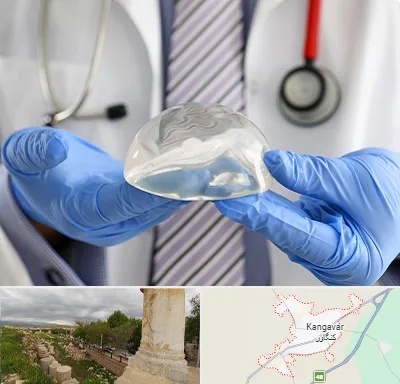 ماموپلاستی در کنگاور