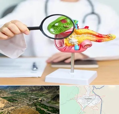 جراح سرطان پانکراس در اسدآباد