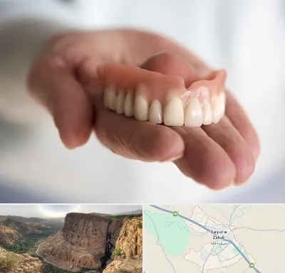 لیفت لثه با لیزر در سرپل ذهاب